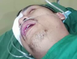 Wartawan Riaumerdeka Dianiaya Hingga Bola Mata Pecah, APH Segera Usut Tuntas