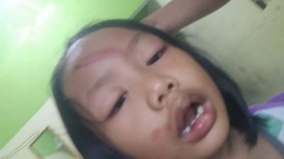 Nasip Vanya Shumaila Bocah 5 Tahun yang di Aniaya Bapak Tirinya di Pondok Cabe